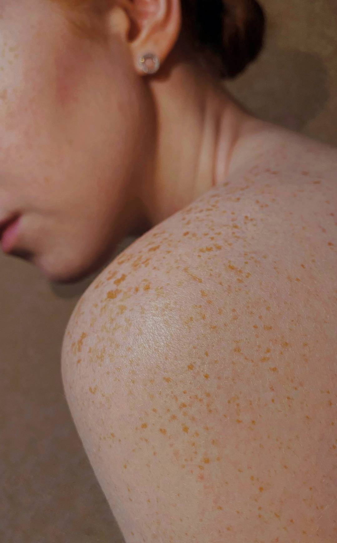 Close de pele real com sardas no ombro e pescoço de uma mulher, em luz suave e quente